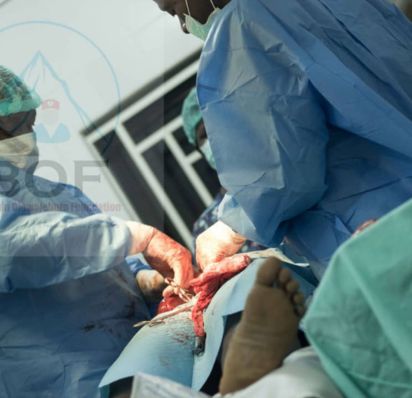 BOF - Surgical intervention