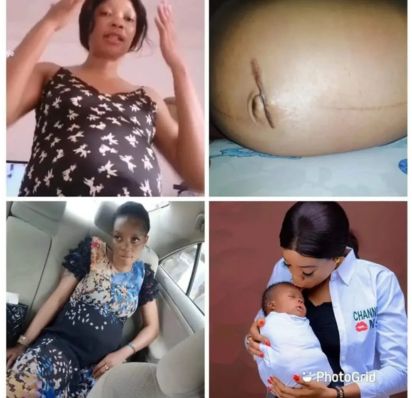 BOF - Surgical intervention